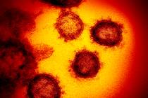 (The Associated Press) This image shows the Novel Coronavirus SARS-CoV-2.