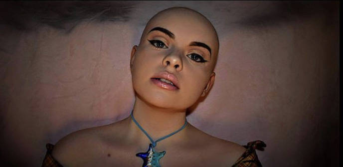 (Mallory Carvalho) This self-portrait of Mallory Carvalho was taken after she lost her hair to ...